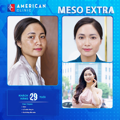 PHÒNG KHÁM DA LIỄU AMERICAN CLINIC - ĐỊA CHỈ LÀM ĐẸP VỀ DA KHÔNG XÂM LẤN