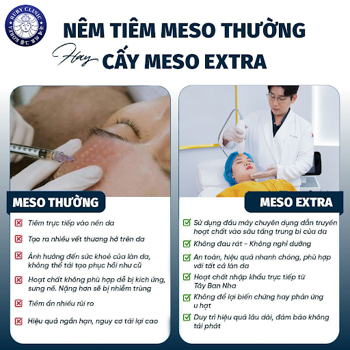 Nên tiêm Meso thông thường hay cấy Meso Extra? Giải đáp từ Dr. Jang Sung Su